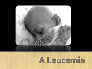 A Leucemia 