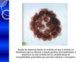 Estado de desenvolvimento do embrião em que é retirado um blastómero para se efectuar o estudo genético pré-implantatório e determinar se este embrião tem as características de compatibilidade pretendidas que permitam efectuar o transplante.