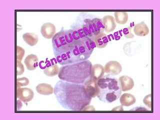 LEUCEMIA “Cáncer de la sangre “ 