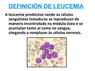 DEFINICIÓN DE LEUCEMIA
A leucemia prodúcese cando as células
  sanguíneas inmaduras se reproducen de
  maneira incontrolada na médula ósea e se
  acumulan tanto aí coma no sangue,
  chegando a remplazar ás células normais.
 