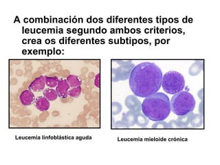A combinación dos diferentes tipos de
 leucemia segundo ambos criterios,
 crea os diferentes subtipos, por
 exemplo:




Leucemia linfoblástica aguda   Leucemia mieloide crónica
 