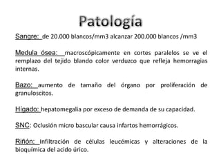 Sangre: de 20.000 blancos/mm3 alcanzar 200.000 blancos /mm3
Medula ósea: macroscópicamente en cortes paralelos se ve el
remplazo del tejido blando color verduzco que refleja hemorragias
internas.
Bazo: aumento de tamaño del órgano por proliferación de
granuloscitos.

Hígado: hepatomegalia por exceso de demanda de su capacidad.
SNC: Oclusión micro bascular causa infartos hemorrágicos.
Riñón: Infiltración de células leucémicas y alteraciones de la
bioquímica del acido úrico.

 