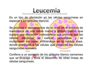 Es un tipo de afectación en las células sanguíneas en
especial a los glóbulos blancos.
Se produce a consecuencia de un error en el proceso de
maduración de una célula madre a glóbulo blanco, que
supone una alteración cromosómica que provoca que las
células afectadas se vuelvan cancerosas y se
multipliquen sin cesar, infiltrándose en la médula ósea,
donde sustituyen a las células que producen las células
sanguíneas normales.
Conlleva a un aumento de los glóbulos blanco canceroso
que se propaga y evita el desarrollo de otras líneas de
células sanguíneas.

 