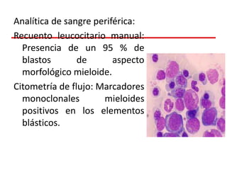 Analítica de sangre periférica:
Recuento leucocitario manual:
Presencia de un 95 % de
blastos
de
aspecto
morfológico mieloide.
Citometría de flujo: Marcadores
monoclonales
mieloides
positivos en los elementos
blásticos.

 