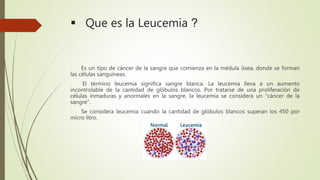  Que es la Leucemia ?
Es un tipo de cáncer de la sangre que comienza en la médula ósea, donde se forman
las células sanguíneas.
El término leucemia significa sangre blanca. La leucemia lleva a un aumento
incontrolable de la cantidad de glóbulos blancos. Por tratarse de una proliferación de
células inmaduras y anormales en la sangre, la leucemia se considera un "cáncer de la
sangre“.
Se considera leucemia cuando la cantidad de glóbulos blancos superan los 450 por
micro litro.
 