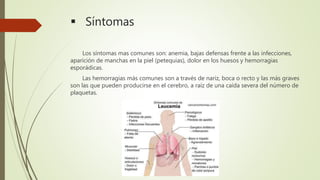  Síntomas
Los síntomas mas comunes son: anemia, bajas defensas frente a las infecciones,
aparición de manchas en la piel (petequias), dolor en los huesos y hemorragias
esporádicas.
Las hemorragias más comunes son a través de nariz, boca o recto y las más graves
son las que pueden producirse en el cerebro, a raíz de una caída severa del número de
plaquetas.
 