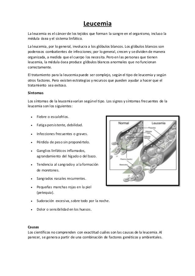 Leucemia Tratamiento Causa Factores De Riesgo Clasificacion