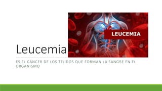 Leucemia
ES EL CÁNCER DE LOS TEJIDOS QUE FORMAN LA SANGRE EN EL
ORGANISMO
 