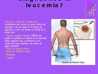 ¿Cómo se diagnostica la leucemia? * Aspiración y biopsia de la médula ósea:  Procedimiento que consiste en extraer médula por aspiración o con una aguja. En la biopsia por aspiración, se retira una muestra de líquido de la médula ósea. * Recuento sanguíneo completo:  Medición del tamaño, la cantidad y la madurez de las diferentes células sanguíneas que se encuentran en un volumen de sangre específico, mas análisis de sangre adicionales * Biopsia del ganglio linfático. * Resonancia magnética nuclear * Radiografía * Ecografía   