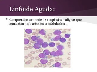 Linfoide Aguda:
•   Comprenden una serie de neoplasias malignas que
    aumentan los blastos en la médula ósea.
 