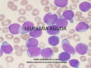 LEUCEMIA AGUDA
CINDY LEDESMA DE LA CRUZ
Médico adscrito al servicio de Hematología
 