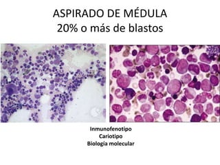 ASPIRADO DE MÉDULA
20% o más de blastos
Inmunofenotipo
Cariotipo
Biología molecular
 