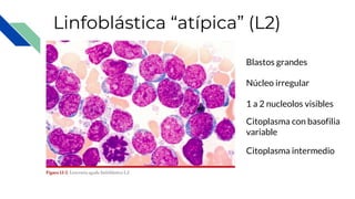 Linfoblástica “atípica” (L2)
Blastos grandes
Núcleo irregular
1 a 2 nucleolos visibles
Citoplasma con basofilia
variable
Citoplasma intermedio
 