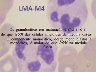 LMA-M4●Os granulocítico em maturação é maiordo que 20% das células mielóides da medula óssea. ● O componente monocítico, desde mono blastos a monócitos, é maior do que 20% na medula óssea.