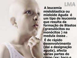 LMA A leucemia mieloblastica ou mieloide Aguda  é um tipo de leucemia  que resulta da formação de Blastos (granulócitos ou monócitos ) na medula óssea . É de rápido desenvolvimento (dai a designação aguda), afecta varias partes do corpo (ex: baço e fígado) é o tipo mais comum e com maior incidência em adultos , ocorre principalmente nos homens. Divide-se em varias subtipos. 
