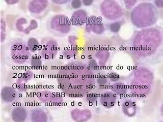 LMA-M2● 30 a 89% das células mielóides da medula óssea são blastos● componente monocítico é menor do que 20%. tem maturação granulocítica● Os bastonetes de Auer são mais numerosos e a MPO e SBB mais intensas e positivas em maior número de blastos