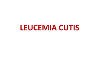 LEUCEMIA CUTIS
 
