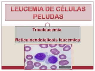 LEUCEMIA DE CÉLULAS PELUDAS Tricoleucemia Reticuloendoteliosis leucémica 