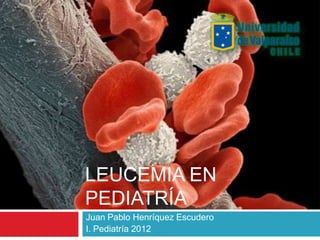LEUCEMIA EN
PEDIATRÍA
Juan Pablo Henríquez Escudero
I. Pediatría 2012
 