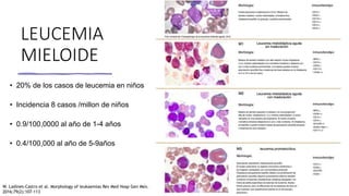 LEUCEMIA
MIELOIDE
• 20% de los casos de leucemia en niños
• Incidencia 8 casos /millon de niños
• 0.9/100,0000 al año de 1-4 años
• 0.4/100,000 al año de 5-9años
W. Ladines-Castro et al. Morphology of leukaemias Rev Med Hosp Gen Méx.
2016;79(2):107-113
 