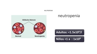 neutropenia
Adultos: <1.5x109/l
Niños <1 a : 1x109
NEUTROPENIA
 