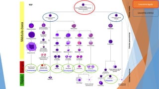 Leucemia Aguda
Leucemia crónica
5
 