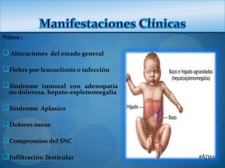 Niños :

 Alteraciones   del estado general

Fiebre por leucocitosis o infección

Síndrome   tumoral con adenopatía
  no dolorosa, hepato-esplenomegalia

Síndrome   Aplasico

Dolores óseos

Compromiso del SNC

Infiltración Testicular
 