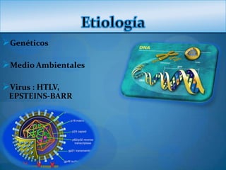 Genéticos

Medio Ambientales

Virus : HTLV,
 EPSTEINS-BARR
 