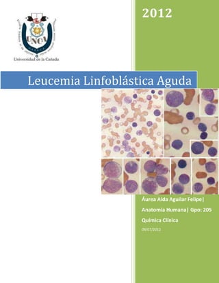 2012




Leucemia Linfoblástica Aguda




                   Áurea Aída Aguilar Felipe|
                   Anatomía Humana| Gpo: 205
                   Química Clínica
                   09/07/2012
 