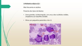 Linfoblastica atípica (L2) : 
Más frecuente en adultos. 
Presenta dos tipos de blastos: 
• Unos grandes, núcleoirregular, con uno a dos nucléolos visibles, 
citoplasma con basofilia variable. 
• Otros son pequeños parecidos a los L1. 
 