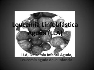Leucemia Linfoblástica Aguda (LLA) LLA, Leucemia Infantil Aguda, Leucemia aguda de la Infancia. 