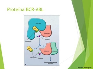 Proteína BCR-ABL
Jéssica Rodrigues
 