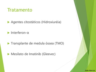 Tratamento
 Agentes citostáticos (Hidroxiuréia)
 Interferon-α
 Transplante de medula óssea (TMO)
 Mesilato de Imatinib (Gleevec)
João Marcos
 