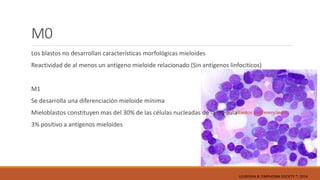 M0
Los blastos no desarrollan características morfológicas mieloides
Reactividad de al menos un antígeno mieloide relacionado (Sin antígenos linfociticos)
M1
Se desarrolla una diferenciación mieloide mínima
Mieloblastos constituyen mas del 30% de las células nucleadas de la medula
3% positivo a antígenos mieloides
LEUKEMIA & LYMPHOMA SOCIETY ®; 2014
 