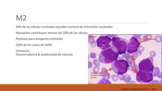 M2
30% de las células nucleadas exceden numero de eritrocitos nucleados
Monocitos constituyen menos del 20% de las células
Positivos para antígenos mieloides
(30% de los casos de LMA)
Fármacos:
Daunorrubicina & arabinosido de citosina
LEUKEMIA & LYMPHOMA SOCIETY ®; 2014
 