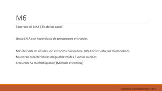M6
Tipo raro de LMA (3% de los casos)
Única LMA con hiperplasia de precursores eritroides
Mas del 50% de células son eitrocitos nucleados- 30% Constituido por mieloblastos
Muestran características megaloblastoides / varios núcleos
Frecuente Sx mielodisplasico (Mielosis eritemica)
LEUKEMIA & LYMPHOMA SOCIETY ®; 2014
 
