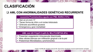 Leucemia mieloide aguda | PDF