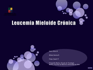 Leucemia Mieloide Crónica Dalia Alfaro B. Milena Cancino R. Felipe Jamett F. Fotografía Medica, Escuela de Tecnología Medica, Facultad de Medicina Universidad de Chile 
