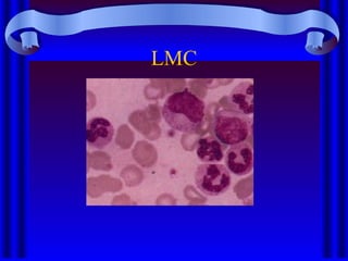LMC
 