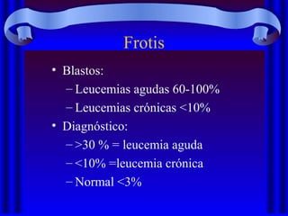 Frotis
• Blastos:
– Leucemias agudas 60-100%
– Leucemias crónicas <10%
• Diagnóstico:
– >30 % = leucemia aguda
– <10% =leucemia crónica
– Normal <3%
 