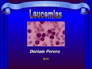 UNAN.MANAGUA Leucemias HAN Doriam Perera 