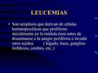 LEUCEMIAS ,[object Object]