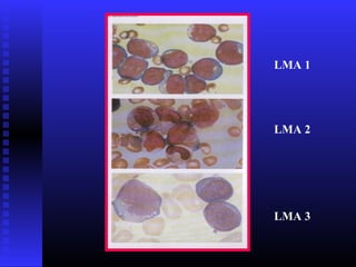 LMA 1
LMA 2
LMA 3
 