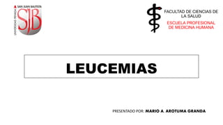 LEUCEMIAS
FACULTAD DE CIENCIAS DE
LA SALUD
ESCUELA PROFESIONAL
DE MEDICINA HUMANA
PRESENTADO POR: MARIO A. AROTUMA GRANDA
 