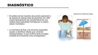 DIAGNÓSTICO
• El análisis de las muestras de punción-aspiración o
de biopsia de médula ósea de pacientes con LMA
revela habitualmente las características de una
médula ósea hipercelular formada por un patrón
celular monofásico
• La citometría de flujo y las tinciones especiales
ayudan a identificar células que contienen
mieloperoxidasa, lo que confirma tanto el origen
mieloide de la leucemia como el diagnóstico.
 