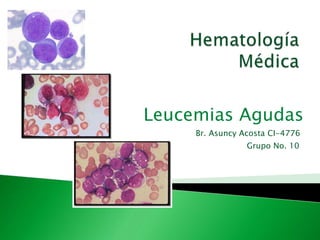 Leucemias Agudas
     Br. Asuncy Acosta CI-4776
                 Grupo No. 10
 
