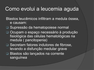 Como evolui a leucemia aguda 
Blastos leucêmicos infiltram a medula óssea, 
e causam: 
 Supressão da hematopoiese normal 
 Ocupam o espaço necessário à produção 
fisiológica das células hematológicas na 
medula ( pancitopenia) 
 Secretam fatores indutores de fibrose, 
levando a disfunção medular grave 
 Blastos são lançados na corrente 
sanguínea 
 