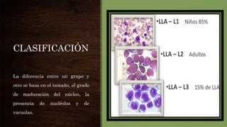 CLASIFICACIÓN
La diferencia entre un grupo y
otro se basa en el tamaño, el grado
de maduración del núcleo, la
presencia de nucléolos y de
vacuolas.
 