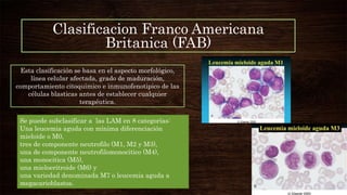 Clasificacion Franco Americana
Britanica (FAB)
Esta clasificación se basa en el aspecto morfológico,
línea celular afectada, grado de maduración,
comportamiento citoquimico e inmunofenotipico de las
células blasticas antes de establecer cualquier
terapéutica.
Se puede subclasificar a las LAM en 8 categorías:
Una leucemia aguda con mínima diferenciación
mieloide o M0,
tres de componente neutrofilo (M1, M2 y M3),
una de componente neutrofilomonocitico (M4),
una monocitica (M5),
una mieloeritroide (M6) y
una variedad denominada M7 o leucemia aguda a
megacarioblastos.
 