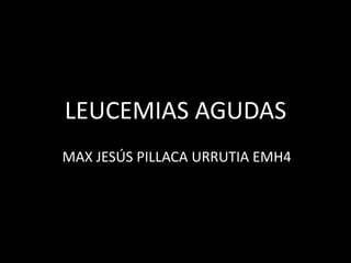 LEUCEMIAS AGUDAS
MAX JESÚS PILLACA URRUTIA EMH4
 